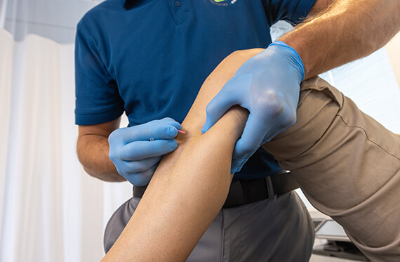 Close up of a patient's shin as a therapist places a dry needle on the patient